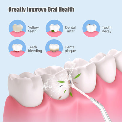 IRRITADOR DENTAL 4 BOQUILLAS